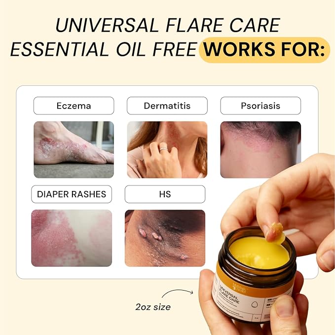 MyMagicHealer Universal Flare Care | Essential Oil Free | Relief for Rashes, Eczema, Psoriasis, Hidradenitis Suppurativa, Impetigo, Dermatitis, Wound Care, Sensitive Skin w/Propolis & Egg Yolk 4 oz