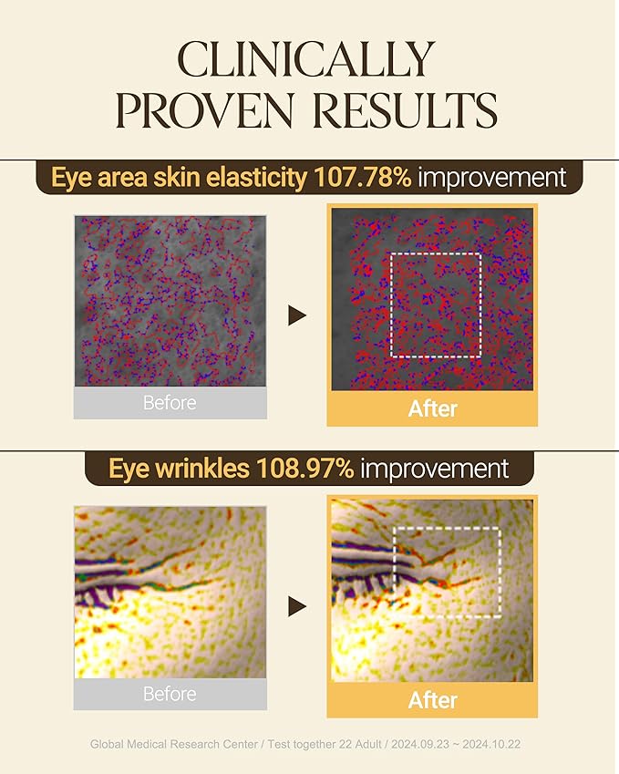 About Me Glycine Soybean Core Eye Cream – Korean Multi-Zone Eye Treatment for All Skin Types – Daily Firming Care with Concentrated Soy Protein & 13 Peptides – Korean Skin Care – 0.51oz, 15ml