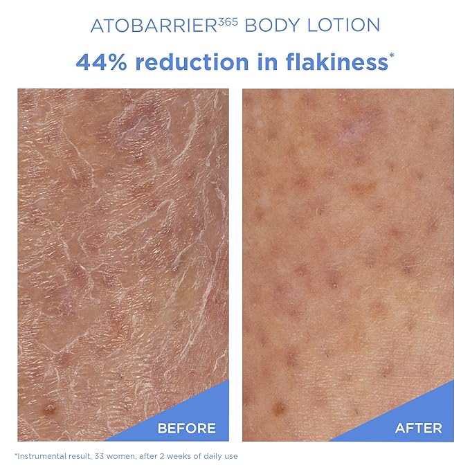 AESTURA ATOBARRIER365 Cream + Body Lotion