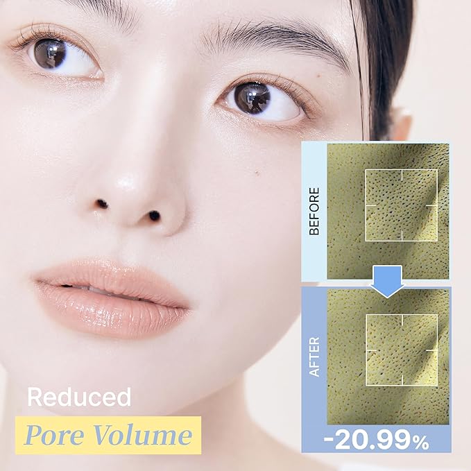 Blue Vitamin Bubble Serum, Niacinamide 50,000ppm, Adenosine, Pore Care & Skin Tone Support, Anti-Wrinkle, Korean Face Serum, 2.36 Fl Oz