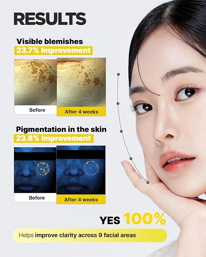 Blemi Shot Cream - Korean Face Moisturizer with Niacinamide & Tranexamic Acid for Smooth Radiant Complexion - Daily Facial Cream Hydrating Formula for Clear Skin, Skin Tone Improvement, 1.69 oz