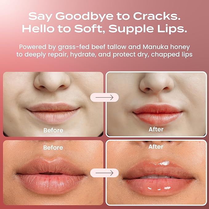 Body Restore Grass Fed Beef Tallow Lip Mask, Manuka Honey – Christmas Stocking Stuffers, White Elephant, Hydrating Moisture, Travel Essentials, Self Care, Birthday Gifts for Women, Men – Unscented