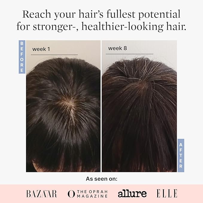 Better Not Younger Superpower+ Advanced Densifying Serum - Hair Fortifier with Biotin, Niacinamide, Rosemary & Apple Cider Vinegar for Stronger, Fuller Hair