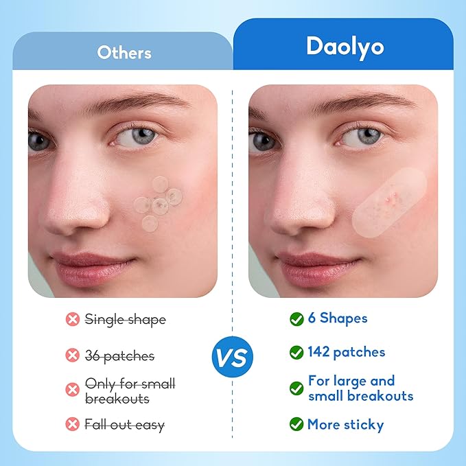 Large Acne Pimple Patches for Face, 6 Sizes 142 Counts Big Hydrocolloid Bandages for Body, Forehead, Chin, Nose, Neck & Chest(Round, Oval, Moon, Square)