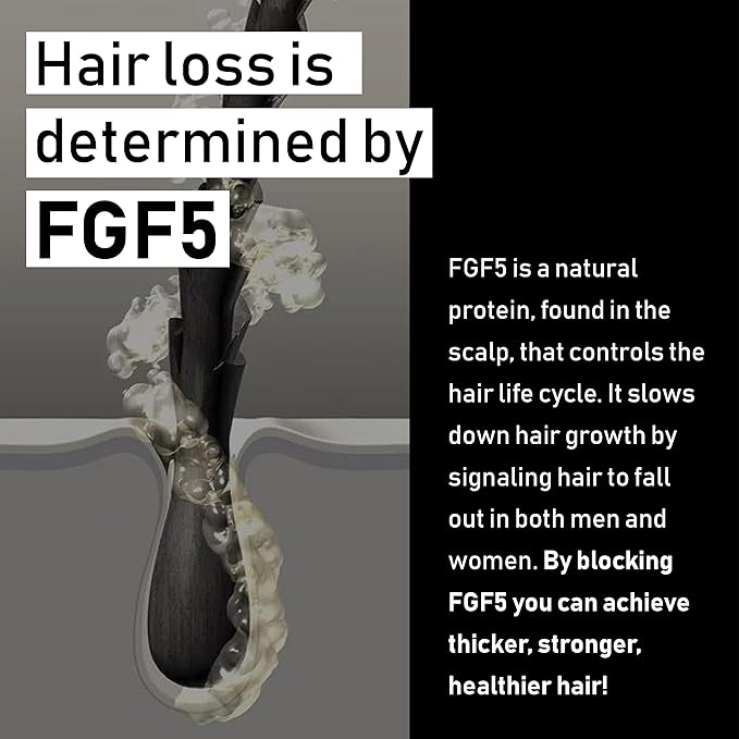 EVOLIS Prevent Anti-Aging Activator Scalp Treatment – Advanced Scalp Serum for Follicle Health – Dry Scalp Treatment with Rosemary Oil (1.7 fl oz)