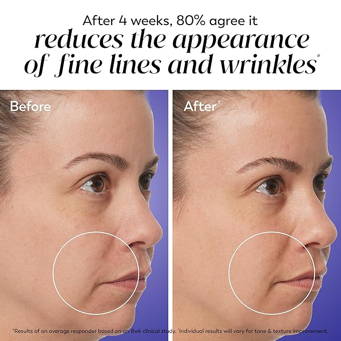 Olay Regenerist Radiance Retinol Face Moisturizer: Smooth & Renew Cream for Women - Fragrance-Free, Anti-Aging, Anti-Wrinkle, Tightening & Brightening - 2 Oz