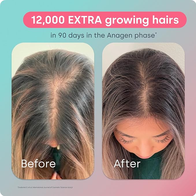 Biosil Advanced Hair Growth Formula - 30 Packets - Promotes Hair (re) Growth, Prevents Hair Loss and Shedding & Increases Thickness and Strength - with Patented ch-OSA - 1 Month Supply