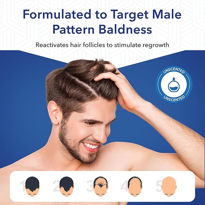 Advanced 5% Minoxidil Topical Solution For Men Hair Growth Serum Treatment for Thinning Hair - Hair Loss for Men - 1 Month Supply, Minoxidil Drop So Thicker Fuller Hair Keeps Growing Amazing Results