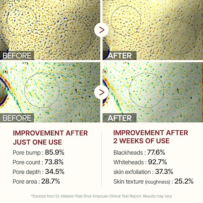 Dr.Melaxin Peel Shot Glow White Rice Peeling Ampoule, Soft Exfoliating Face and Body Scrub Dead Skin Cells Remover for All Skin Types korean skin care 80ml