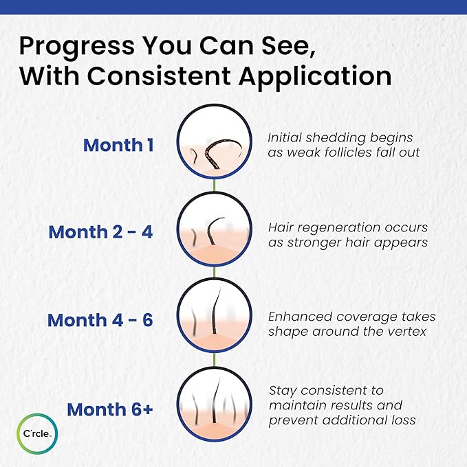 C’rcle Men's Minoxidil 5% Foam - Unscented 6 Month Supply - Helps Restore Vertex Hair Loss & Thinning - Extra Strength Supports Hair Regrowth for Men