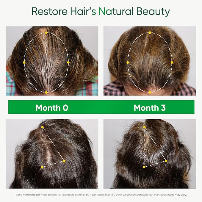 Hair Serum Scalp Care for Men & Women 50 ml