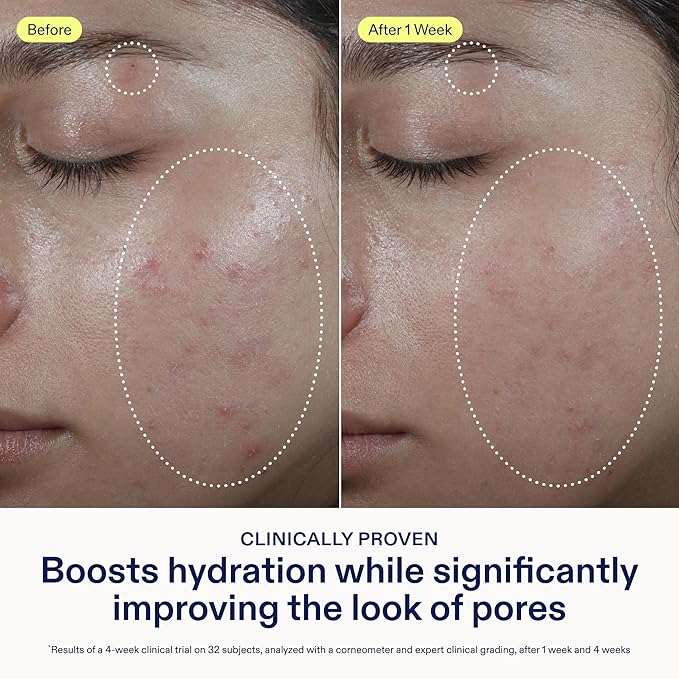 Skinfix Barrier Balancing Water Cream - 1.7 oz - Weightless Moisturizer with Hyaluronic Acid & Niacinamide - Combo + Oily Skin - Acne-Safe, Non-Comedogenic, Fragrance Free, Vegan, Cruelty Free