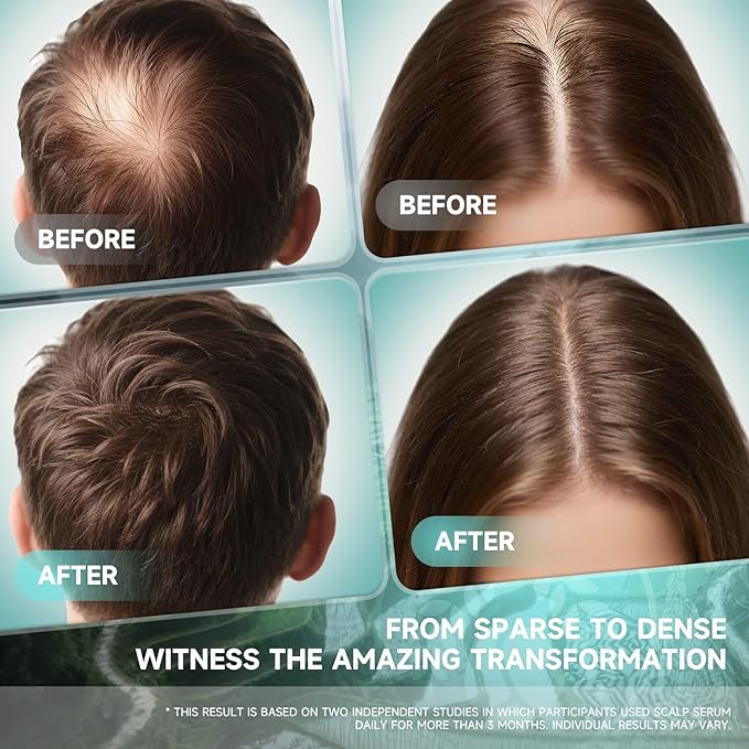 Hair Growth Serum Oil for Women - Rosemary Batana Rice Water Biotin Hair Spray for Hair Growth - Hair Growth Thickening Product - Hair Loss/Shedding,Thin, Dry & Damaged for Women Men(60 ML/2.0FL.oz)