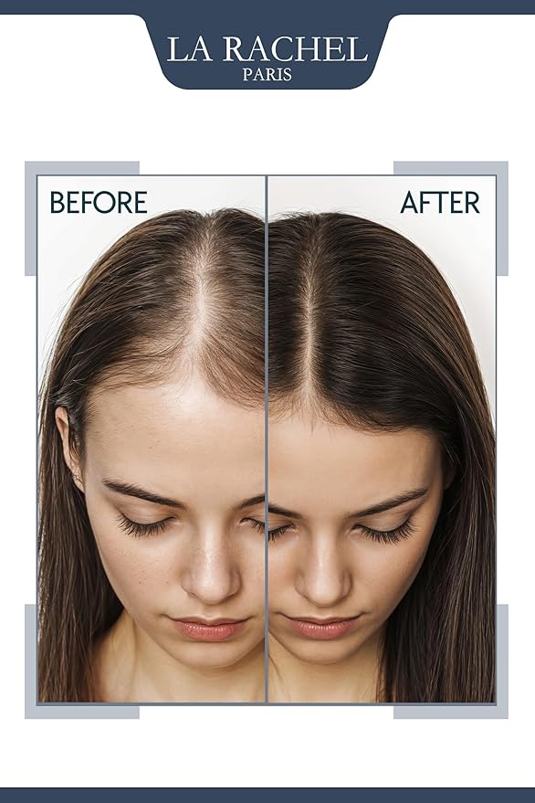 Anti-Hair Loss Tonic with Biotin, Panthenol & Caffeine | Hair Growth Treatment for Men and Women | Scientifically Proven Formula to Strengthen and Revitalize Thinning Hair by La Rachel Paris