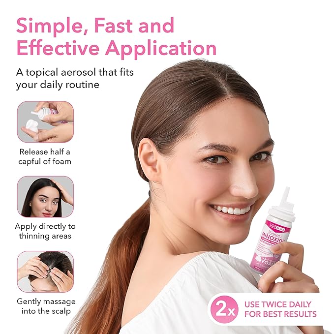 Hair-Regen Women’s 5% Minoxidil Foam – 1-Month Supply for Hair Regrowth – Clinically Proven Topical Treatment for Thinning Hair, Hair Loss & Female Pattern Baldness – Minoxidil for Women