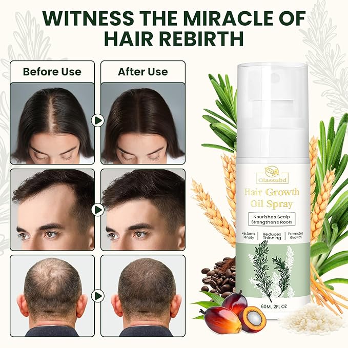 Hair Growth Oil Spray with Rosemary Batana Oil Biotin Caffeine for Hair Growth Spray Anti Hair Loss Repair of Sparse Hair for Women Men 2 Bottles 2 FL OZ Each