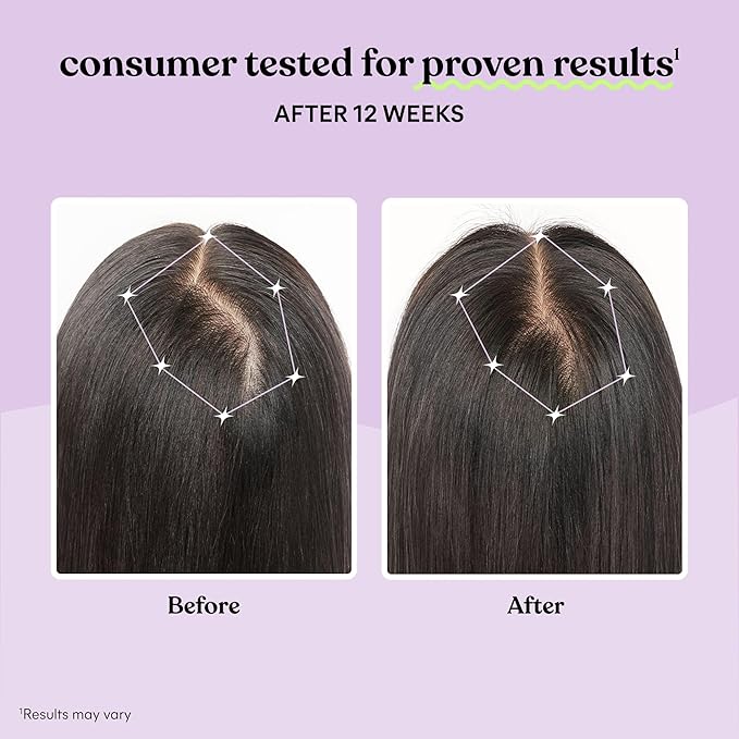 Lemme Grow Hair Growth Supplement for Women, Clinically Proven Keratin Complex for Visibly Thicker Hair and Scalp Coverage, Reduced Shedding, Nourish Thinning Hair - 1 Month Supply