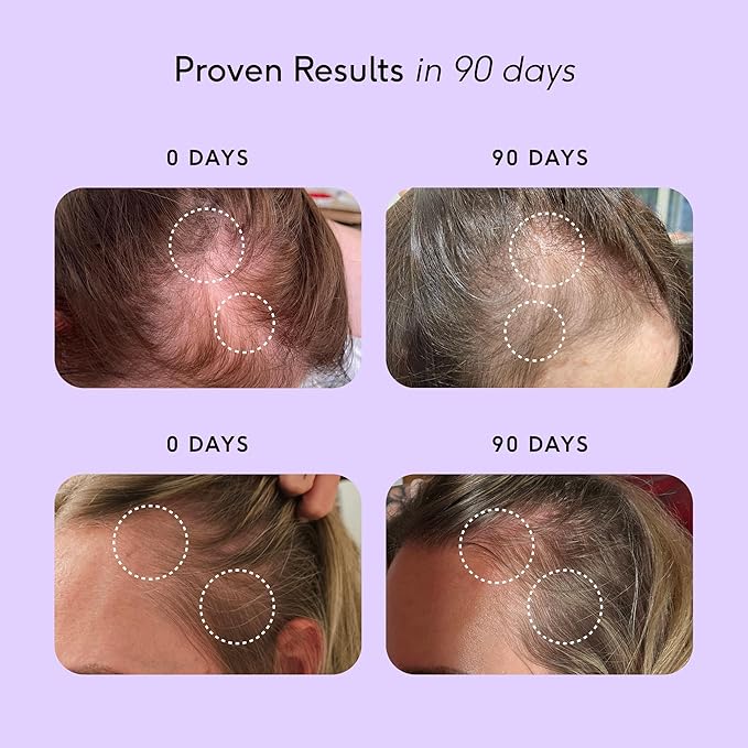 Feel Hair Support, Natural Support for Female Hair loss and Thinning Hair, Vegan, Contains Biotin and Rosemary Oil, 30 Capsules