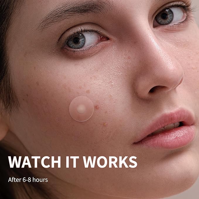 Pimple Patches for Face, 4 Size 360 Counts Hydrocolloid Acne Patches for Covering Zits and Blemishes, Spot Stickers with Salicylic Acid, Tea Tree Oil & Calendula Oil, Mini Package