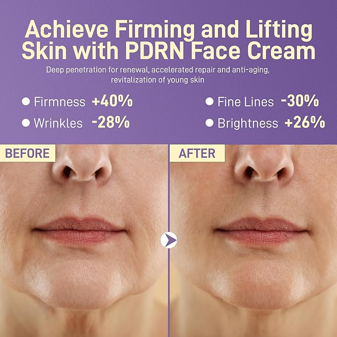 PDRN Anti-Aging Face Moisturizers Cream with 5% Squalane - 100% Pure PDRN Salmon DNA,Hyaluronic Acid & B5, Firming, Hydrating, Moisturizing Repair Face & Neck Skinare Cream for All Skin,1.85 Fl Oz
