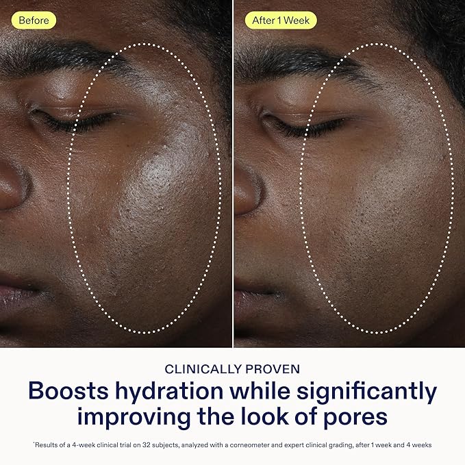 Skinfix Barrier Balancing Water Cream - 1.7 oz - Weightless Moisturizer with Hyaluronic Acid & Niacinamide - Combo + Oily Skin - Acne-Safe, Non-Comedogenic, Fragrance Free, Vegan, Cruelty Free