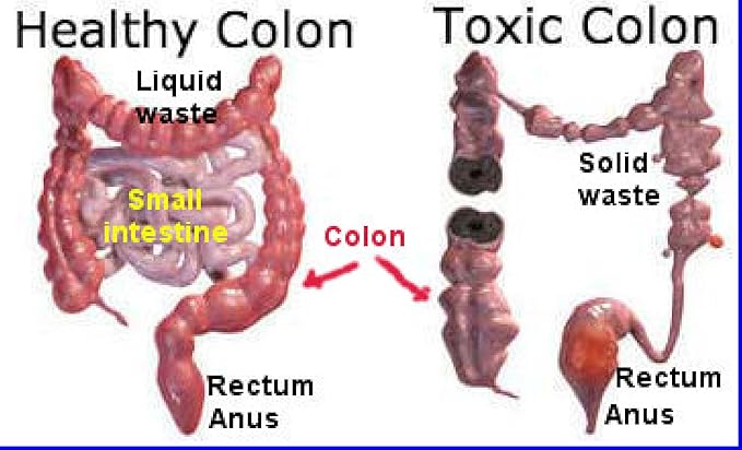 The One Minute Miracle - Miracle Oxy-Colon Cleanse - Colon Cleanser for 2 Day Cleanser
