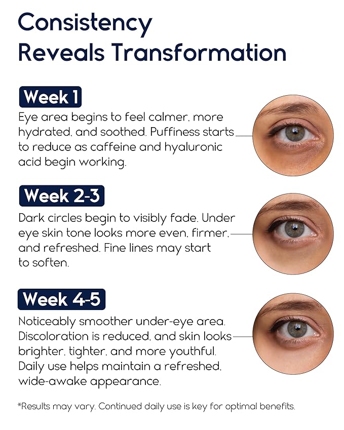 Under Eye Cream for Puffiness and Bags Under Eyes, Eye Bags Treatment for Men & Women - Anti Wrinkle Cream for Dark Circles, Baggy Eyes Treatment for Women with Retinol, Hyaluronic Acid & Caffeine