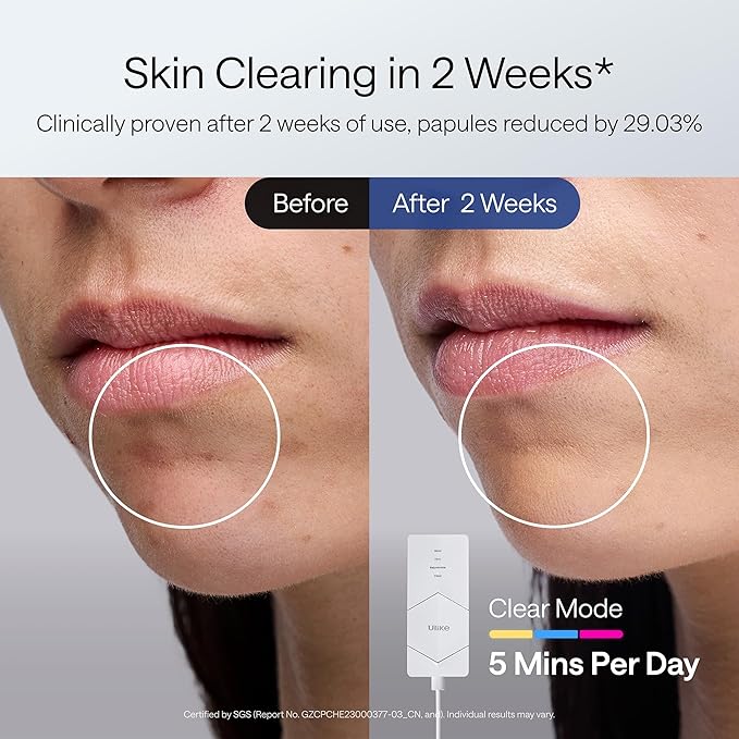 Ulike ReGlow LED Light Therapy Mask, Red Light Therapy for Face, 4 Modes with Red, Blue, Yellow & Infrared Lights for Reduce Acne & Anti-Aging, Eye-Protection, 272 Beads, Remote Control,White