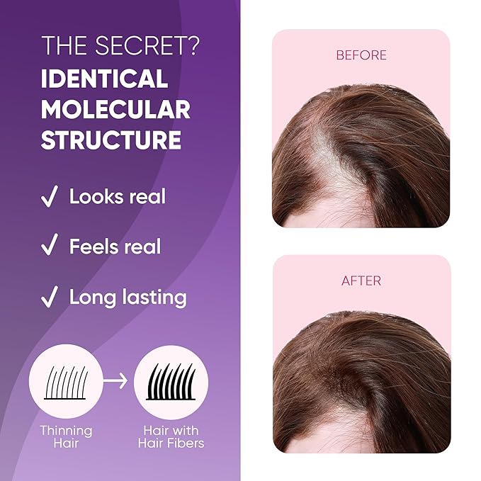 GBG Hair Fibers for Thinning Hair & Bald Spots (White) - 25g Bottle - Conceals Hair Loss - Instant Cover Up & Volume in 30 Seconds, Hair Powder for Women & Men - Cruelty Free