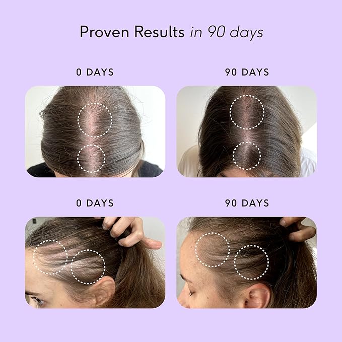 Feel Hair Support, Natural Support for Female Hair loss and Thinning Hair, Vegan, Contains Biotin and Rosemary Oil, 30 Capsules