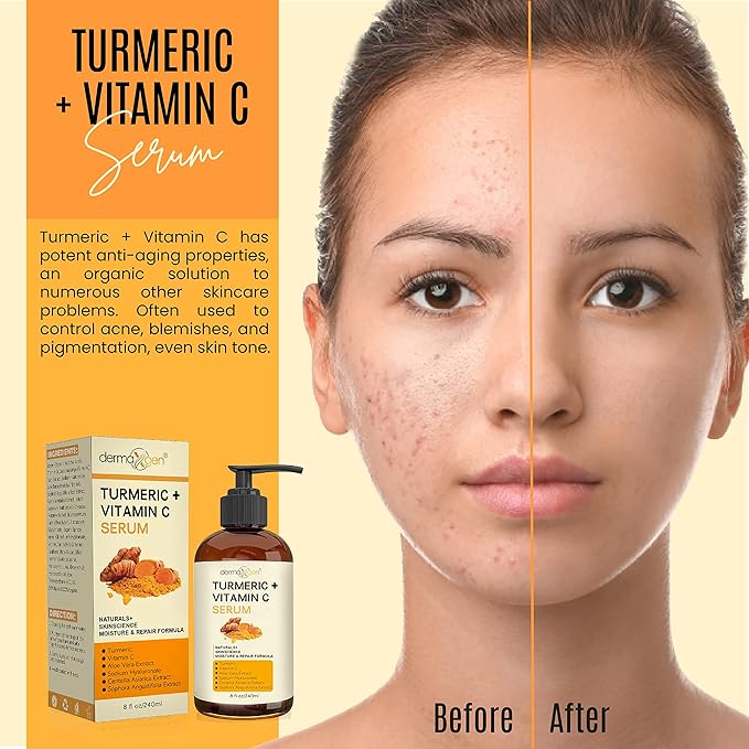 Turmeric Serum for Face + Glow-Boosting Vitamin C Serum - Organic Moisturizer for Dark Spots & Clear Wrinkles - Boosts Hydration for Dry & Tired Skin - Anti-Aging Formula for Glowing Skin - 8 FL OZ
