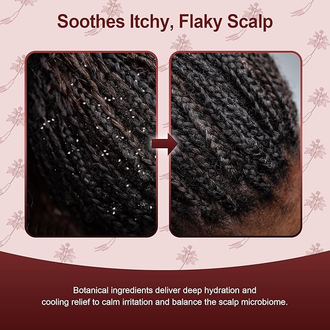 Korea Hair Loss Shampoo – Strengthens Roots & Reduces Hair Fall, 16.9 fl oz