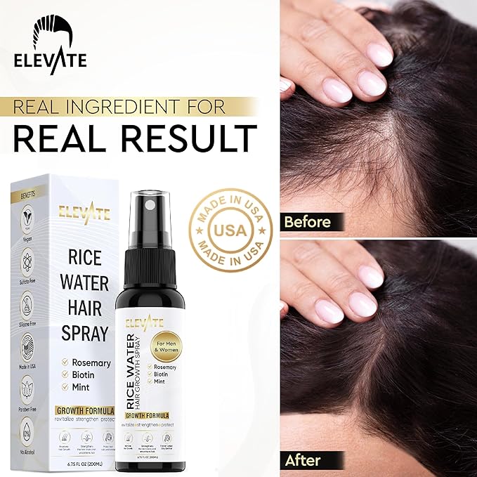 Elevate Rice Water Spray for Hair Growth - Fermented Rice Water & Rosemary Hair Mist with Biotin - Vegan Leave-In Treatment for Stronger, Thicker, Healthier Hair - Scalp Care for Women & Men