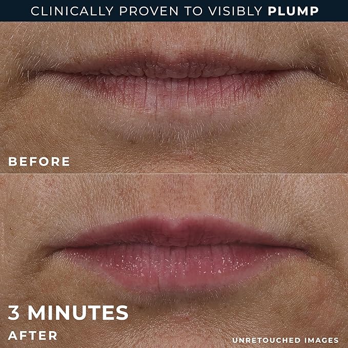 RoC Derm Correxion Lip Volumizer - Lip Plumper Peptide Treatment with Hyaluronic Acid & Vitamin E + Line Smoothing Eye Cream Packette