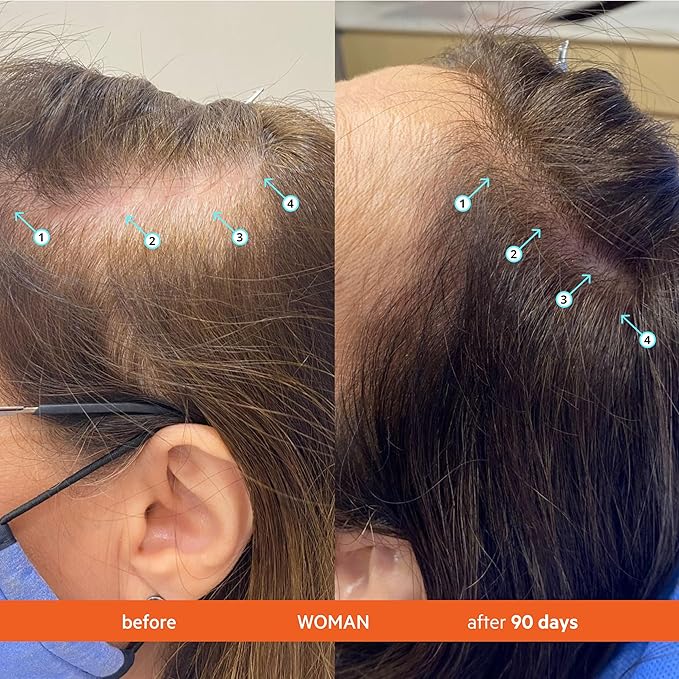 DS Labs Revita Conditioner, 500mL - Lightweight, Scalp First Hydration for Fuller Looking, Softer Hair, Thickening Appearance, Sulfate & Silicone Free, Color Safe, For Men & Women