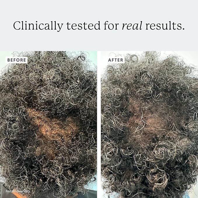 Densifying Scalp Serum, 1 fl oz, with Procapil and Redensyl