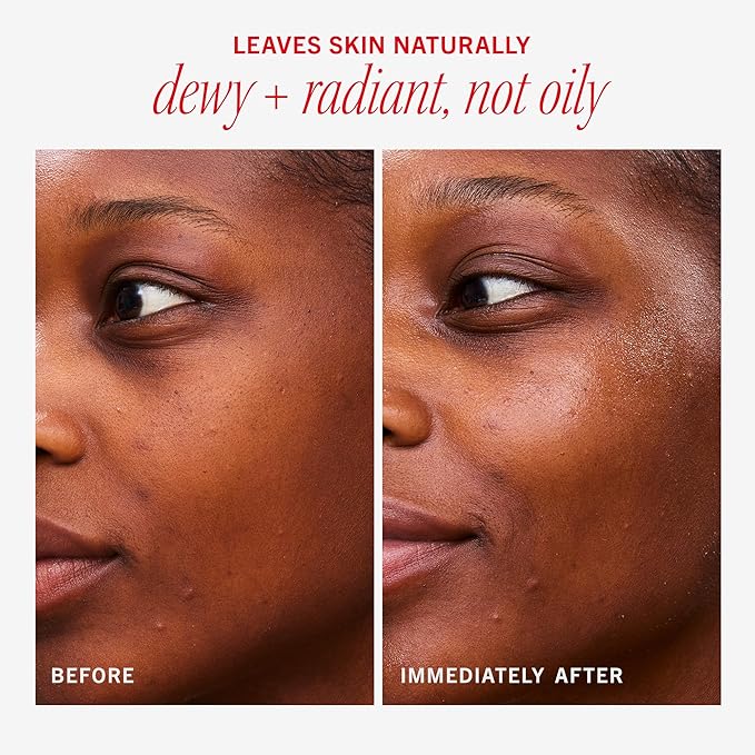 First Aid Beauty - Hydrating Dewy Gel Cream, Lightweight Oil-Free Facial Moisturizer with Hyaluronic Acid and Ceramides, Helps Reduce Excess Oil Build Up & Improve Skins Hydration, 1.9 FL oz