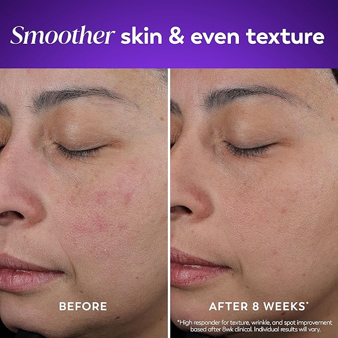 Olay Retinol Night Cream for Women, Anti-Aging Face Moisturizer, Fragrance-Free, Gift for Women, Non Greasy - Anti-Wrinkle, Hydrating Skin Care - Triple Collagen Cream, Peptide, Niacinamide, 1.7oz